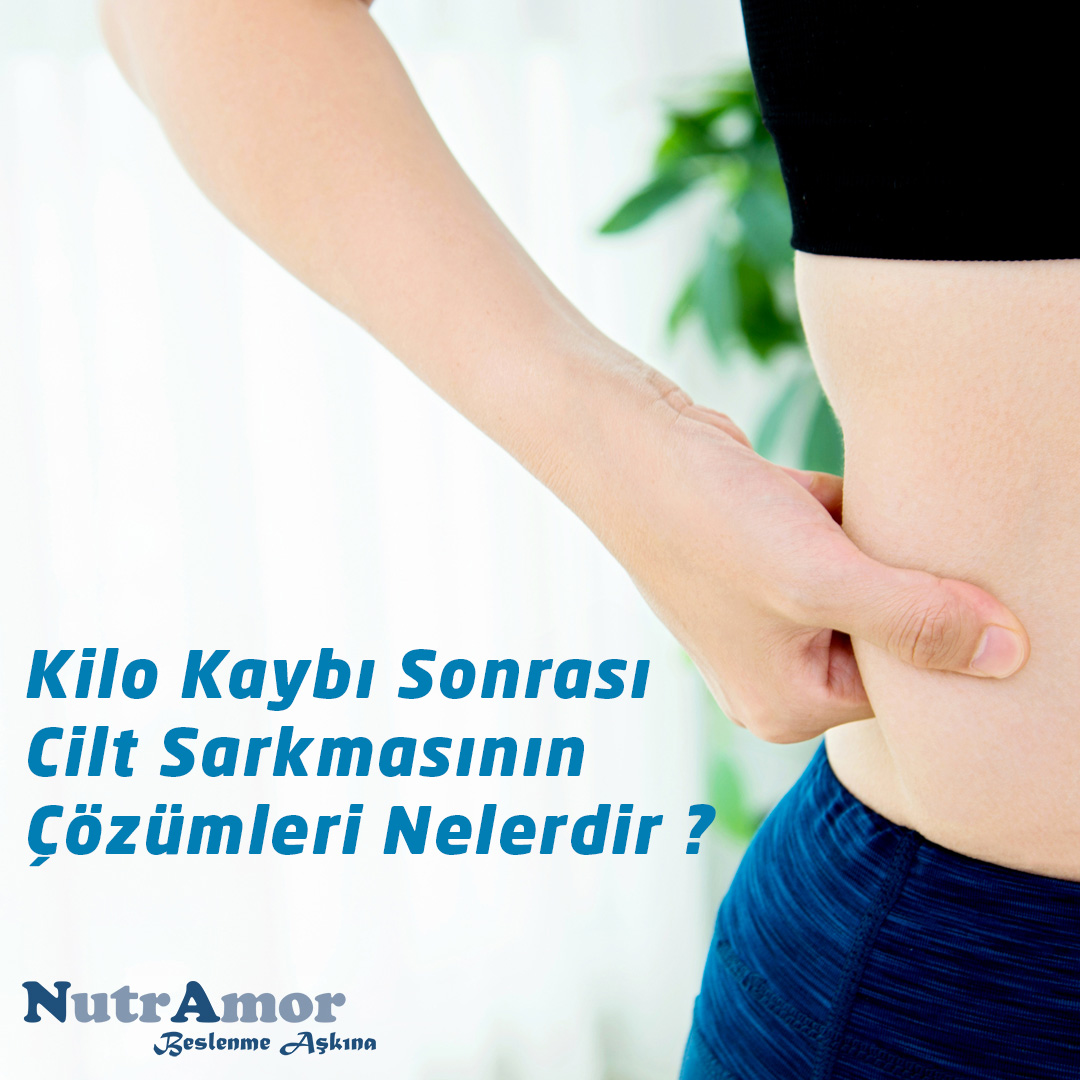 Bariatrik Cerrahi SonrasI Cilt Sarkması Çözümleri